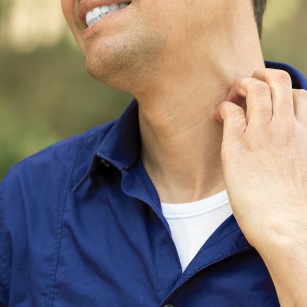 st. louis worker with an insect bite